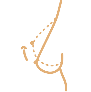 Brustästhetik